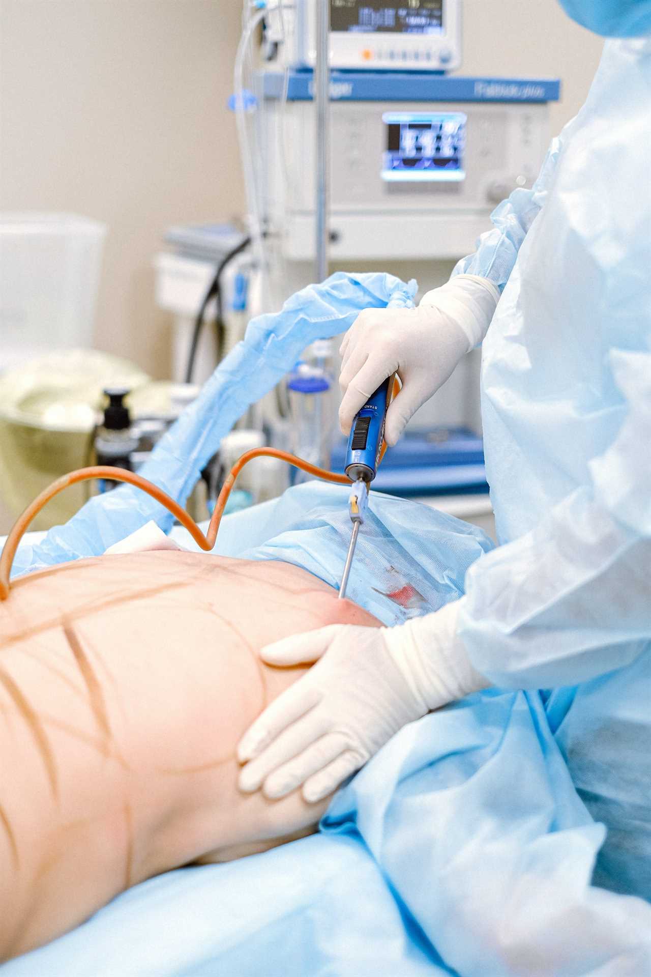 Things That You Need to Consider Before Going for A Liposuction Procedure