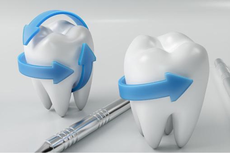 Improve The Success Rate of Your Dental Implant by Indulging In Good Oral Practices