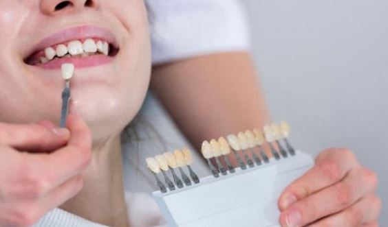 Porcelain Veneer Cost in Turkey