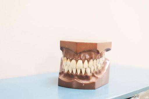What Are Dental Veneers and How to Install Porcelain Dental Veneers?
